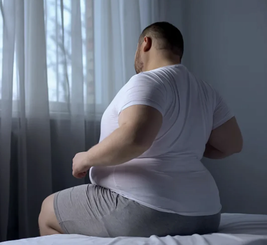 Obesity at Ayurgreen Hospital
